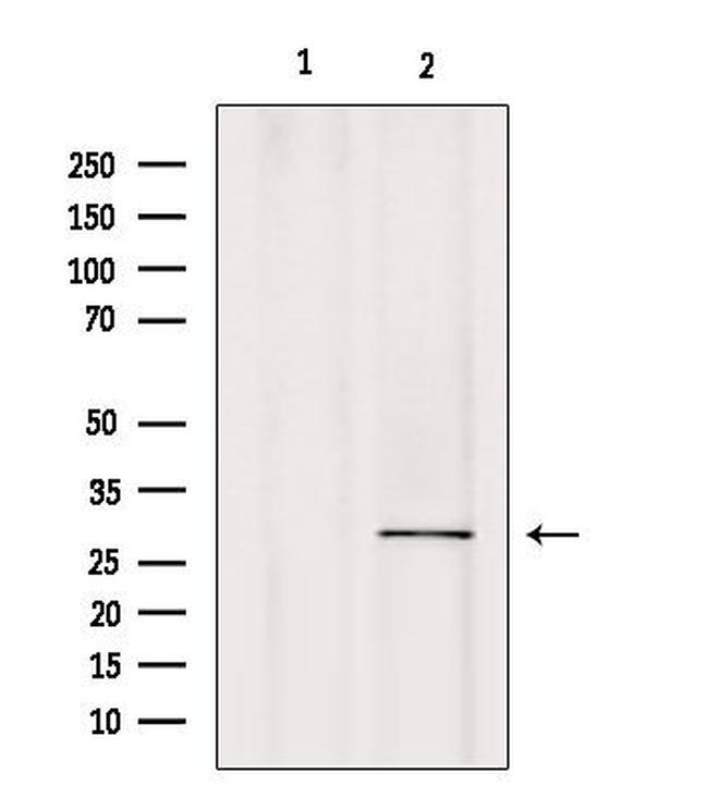 CA7 Antibody in Western Blot (WB)
