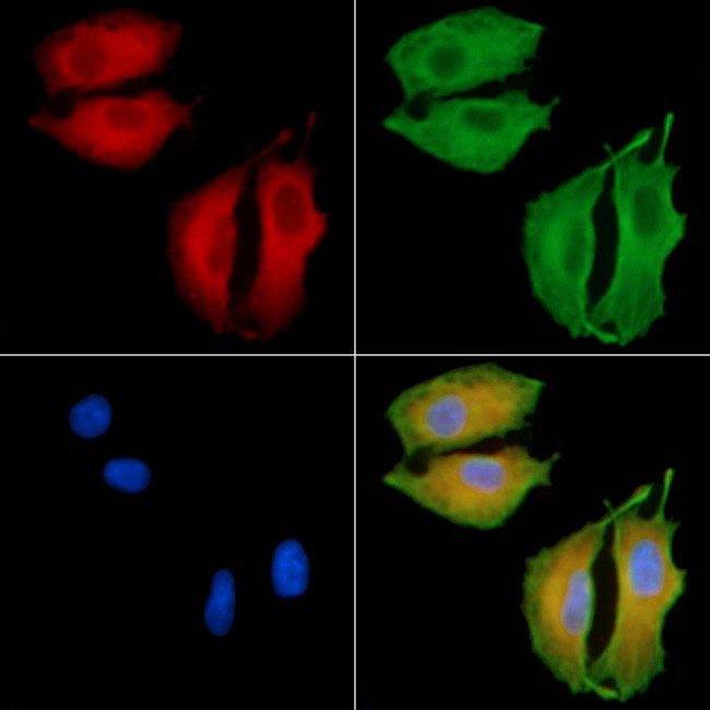 CATSPER1 Antibody in Immunocytochemistry (ICC/IF)