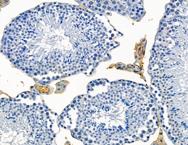 CATSPER1 Antibody in Immunohistochemistry (Paraffin) (IHC (P))