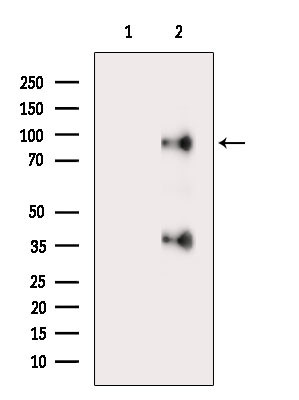 CATSPER1 Antibody in Western Blot (WB)