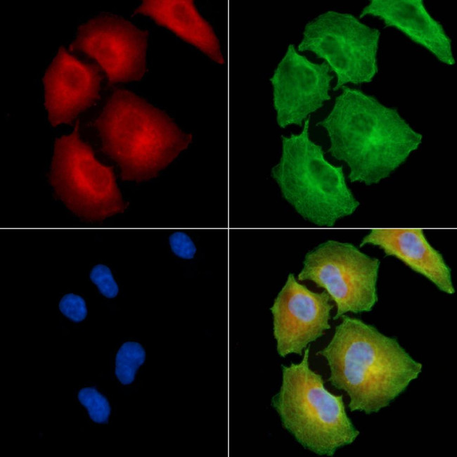 CATSPERB Antibody in Immunocytochemistry (ICC/IF)