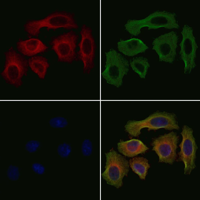 CHAC1 Antibody in Immunocytochemistry (ICC/IF)