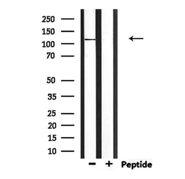 CCP110 Antibody in Western Blot (WB)