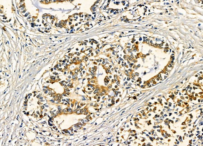 HAUS2 Antibody in Immunohistochemistry (Paraffin) (IHC (P))