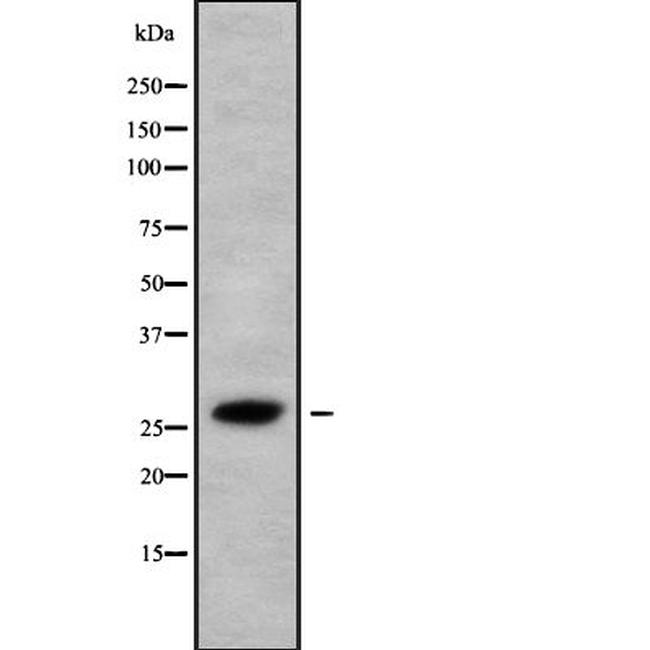 HAUS2 Antibody in Western Blot (WB)