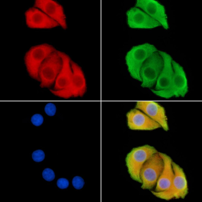 CEP63 Antibody in Immunocytochemistry (ICC/IF)