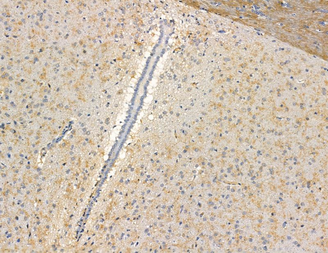 CEP63 Antibody in Immunohistochemistry (Paraffin) (IHC (P))