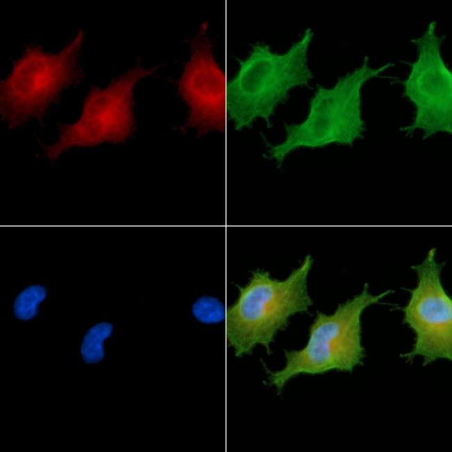 CSPP1 Antibody in Immunocytochemistry (ICC/IF)