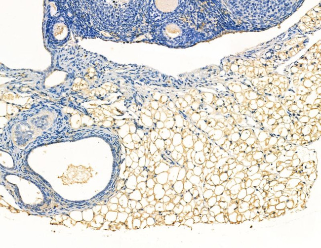 PDE3B Antibody in Immunohistochemistry (Paraffin) (IHC (P))