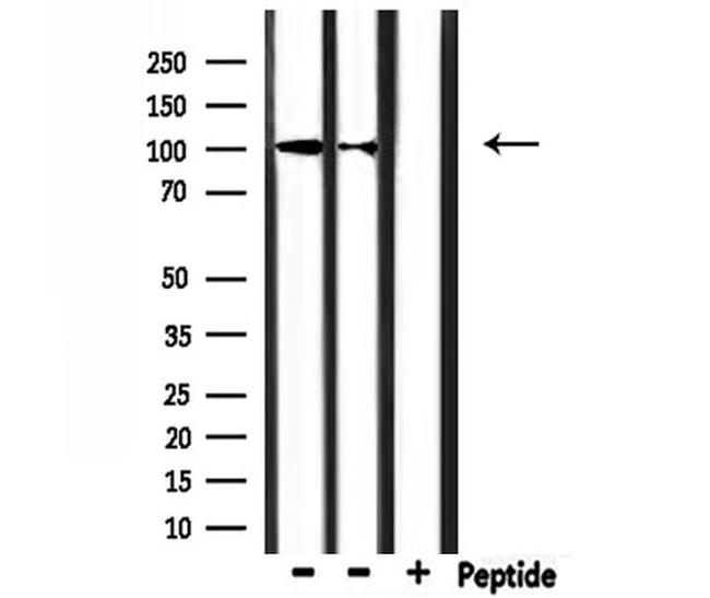 CHSY3 Antibody in Western Blot (WB)