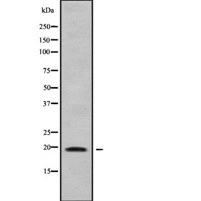 CMTM7 Antibody in Western Blot (WB)