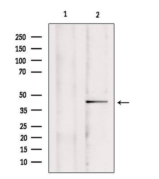 MCU Antibody in Western Blot (WB)