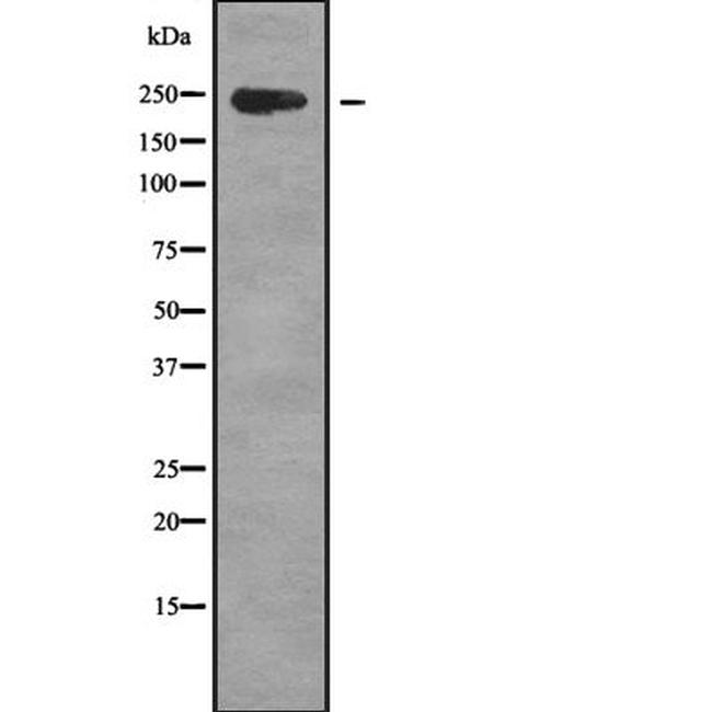 ZFC3H1 Antibody in Western Blot (WB)