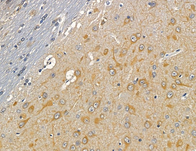 CNGB3 Antibody in Immunohistochemistry (Paraffin) (IHC (P))