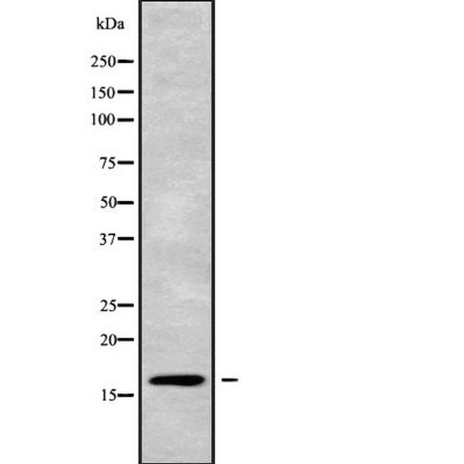 Cystatin D Antibody in Western Blot (WB)