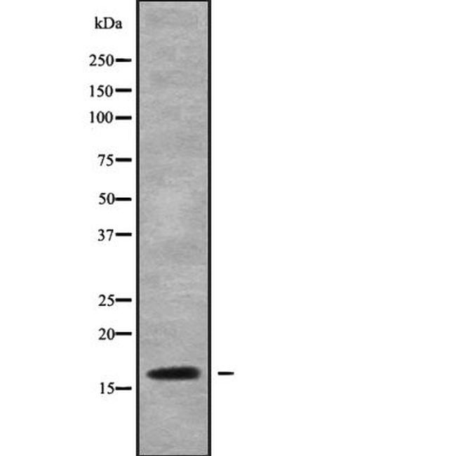 Cystatin F Antibody in Western Blot (WB)