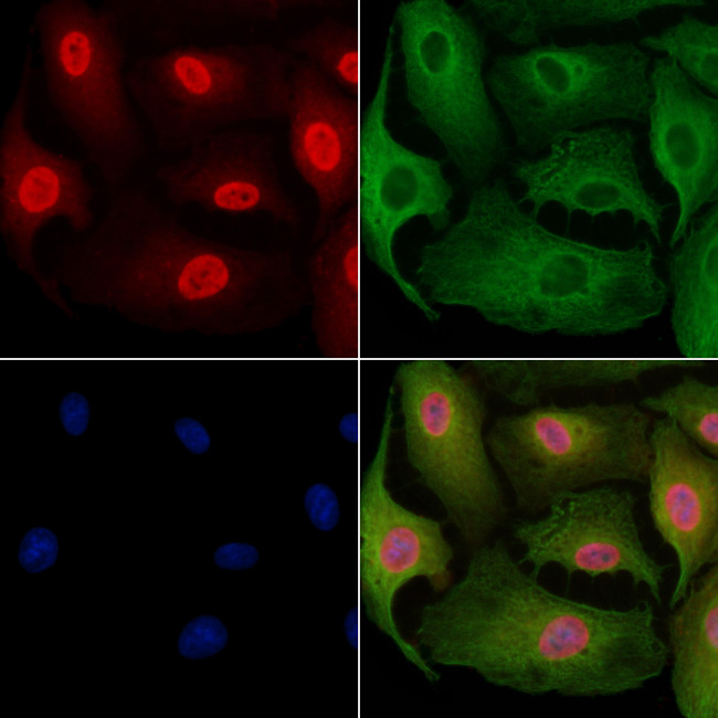 DHRS1 Antibody in Immunocytochemistry (ICC/IF)