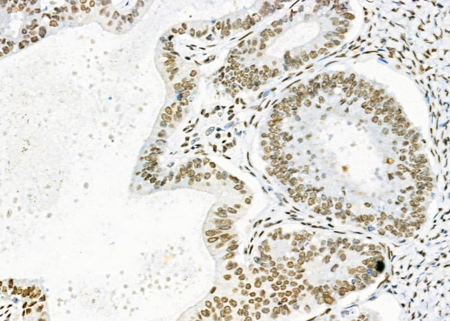 DHRS1 Antibody in Immunohistochemistry (Paraffin) (IHC (P))