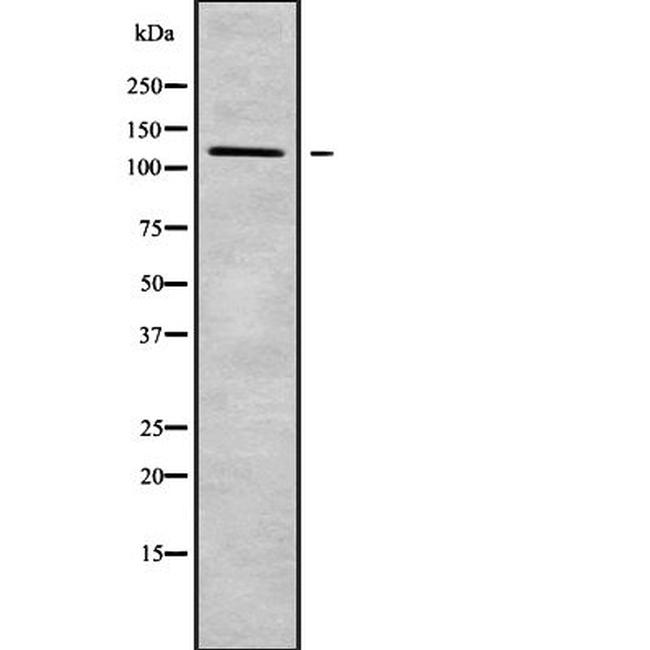 Desmoglein 4 Antibody in Western Blot (WB)