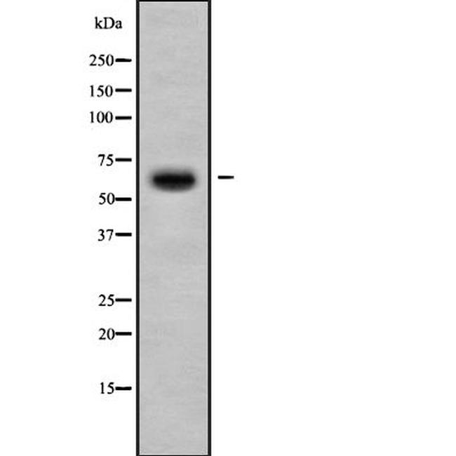 DCLRE1B Antibody in Western Blot (WB)