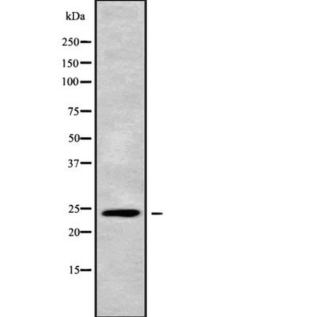 APOBEC3H Antibody in Western Blot (WB)