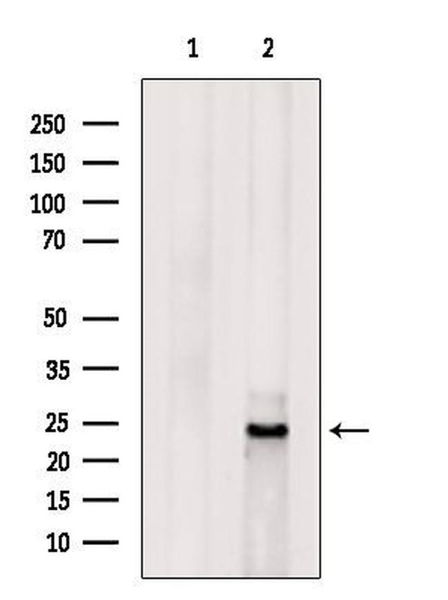 GINS1 Antibody in Western Blot (WB)