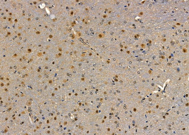 POLR3G Antibody in Immunohistochemistry (Paraffin) (IHC (P))