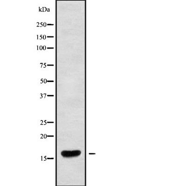 CRCP Antibody in Western Blot (WB)