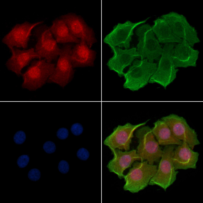 POLR1D Antibody in Immunocytochemistry (ICC/IF)