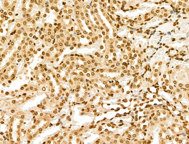 POLR1D Antibody in Immunohistochemistry (Paraffin) (IHC (P))