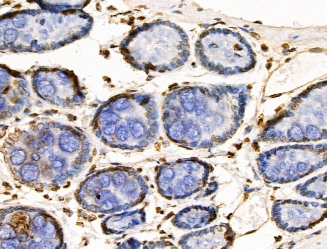 POLR1D Antibody in Immunohistochemistry (Paraffin) (IHC (P))