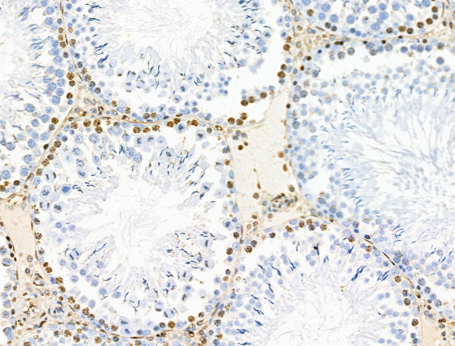 POLR1D Antibody in Immunohistochemistry (Paraffin) (IHC (P))