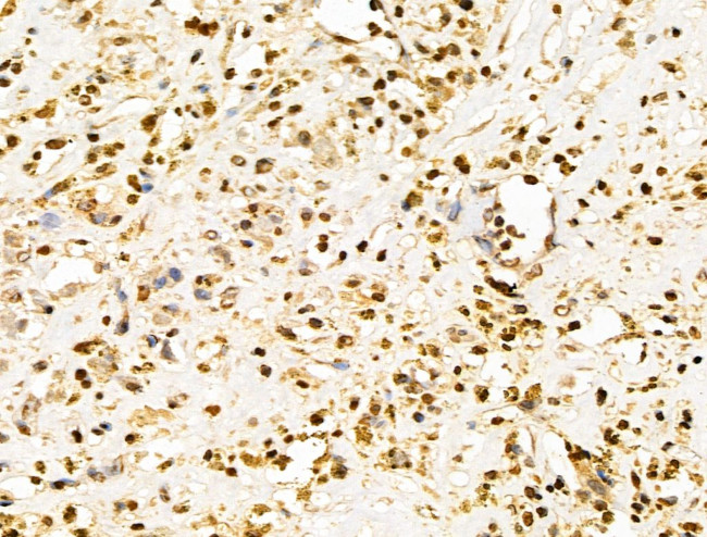 POLR1D Antibody in Immunohistochemistry (Paraffin) (IHC (P))