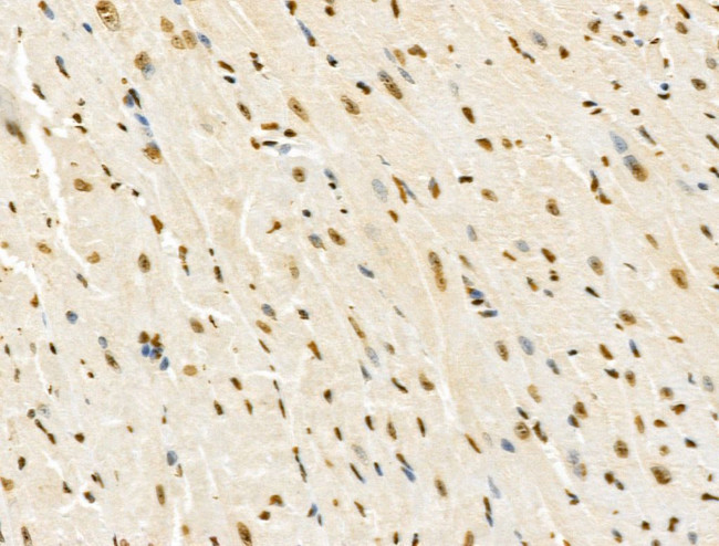 POLR1D Antibody in Immunohistochemistry (Paraffin) (IHC (P))