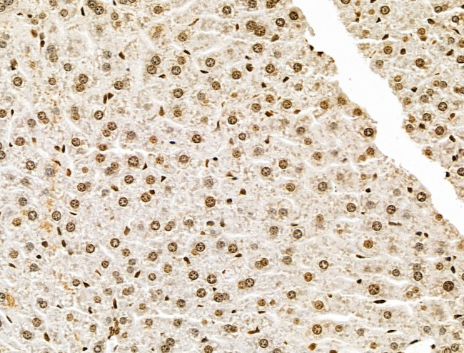 POLR1D Antibody in Immunohistochemistry (Paraffin) (IHC (P))