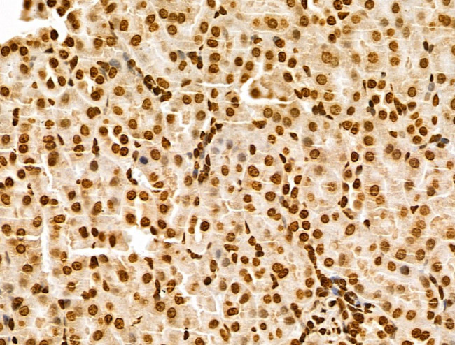 POLR1D Antibody in Immunohistochemistry (Paraffin) (IHC (P))