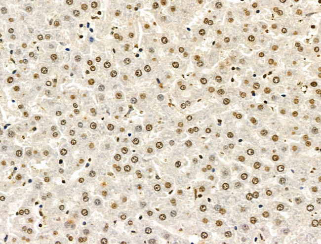 POLR1D Antibody in Immunohistochemistry (Paraffin) (IHC (P))