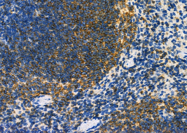 DYNLRB1 Antibody in Immunohistochemistry (Paraffin) (IHC (P))