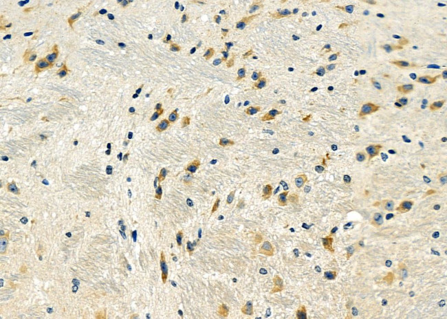 DYNLRB1 Antibody in Immunohistochemistry (Paraffin) (IHC (P))