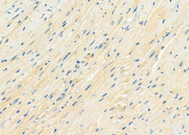 DYNLRB1 Antibody in Immunohistochemistry (Paraffin) (IHC (P))