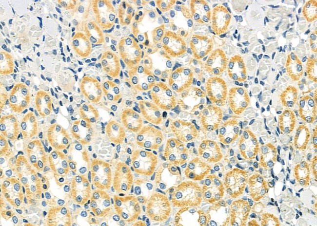 LRSAM1 Antibody in Immunohistochemistry (Paraffin) (IHC (P))