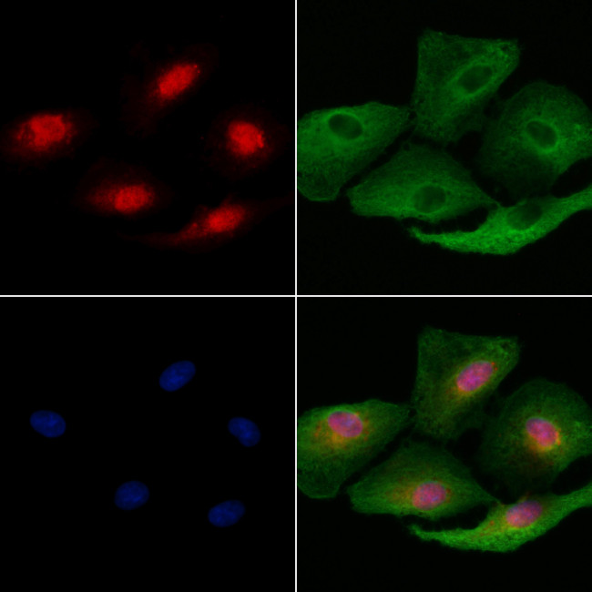 RNF41 Antibody in Immunocytochemistry (ICC/IF)