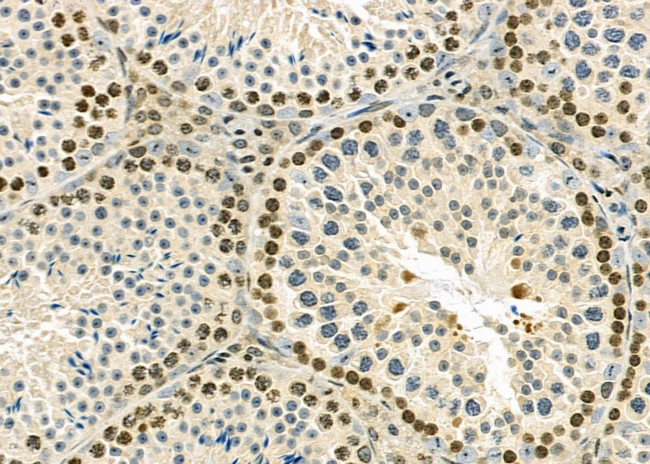 RNF41 Antibody in Immunohistochemistry (Paraffin) (IHC (P))