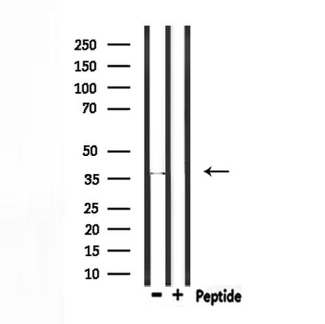 RNF41 Antibody in Western Blot (WB)