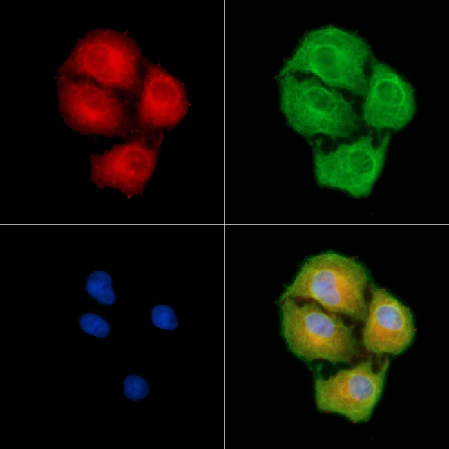 HSD17B8 Antibody in Immunocytochemistry (ICC/IF)