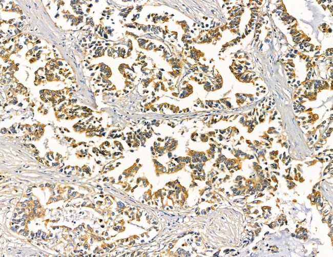 HSD17B8 Antibody in Immunohistochemistry (Paraffin) (IHC (P))