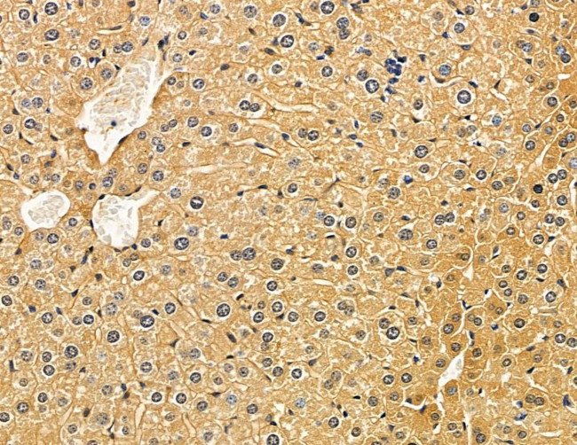 HSD17B8 Antibody in Immunohistochemistry (Paraffin) (IHC (P))