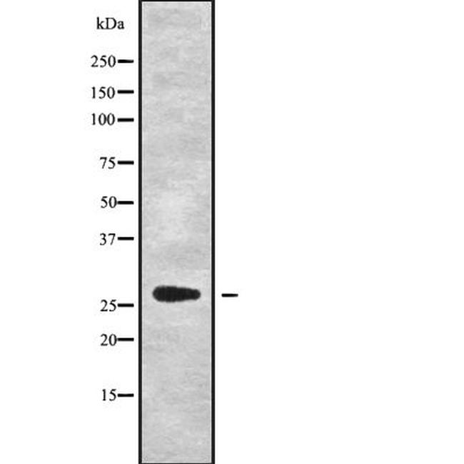 HSD17B8 Antibody in Western Blot (WB)