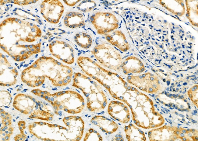 EIF1B Antibody in Immunohistochemistry (Paraffin) (IHC (P))