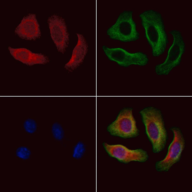 Fibulin 1 Antibody in Immunocytochemistry (ICC/IF)